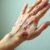 Choroby skóry dłoni: objawy, przyczyny i skuteczne leczenie
